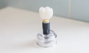 affordable dental implants in bethpage