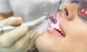 different dental filling options