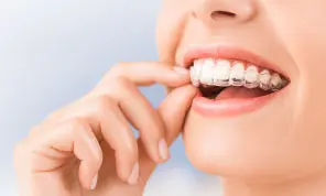 Invisalign And Braces Procedures Near Levittown