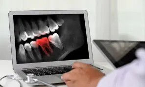 Root Canal Therapy Near Levittown