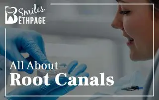 All About Root Canals