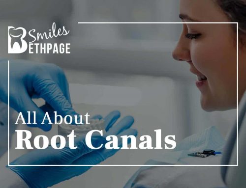 All About Root Canals