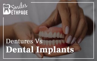 Dentures Vs Dental Implants