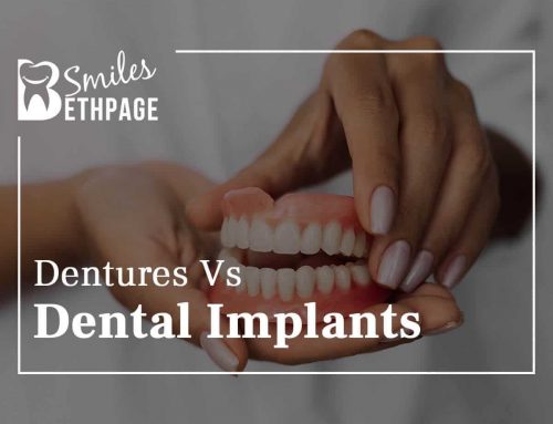 Dentures Vs Dental Implants