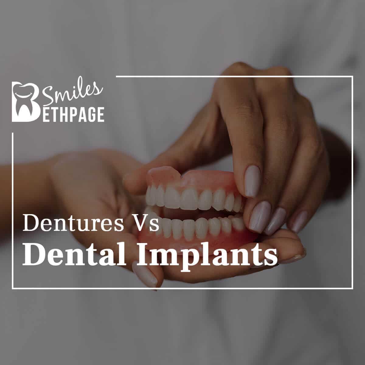 Dentures Vs Dental Implants
