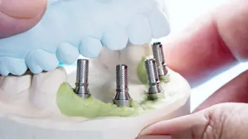 affordable dental implants