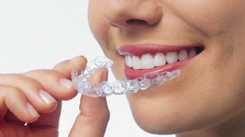 affordable invisalign