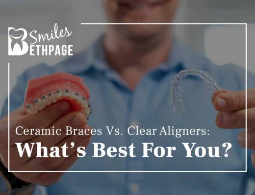 Ceramic Braces Vs. Clear Aligners: What’s Best For You?