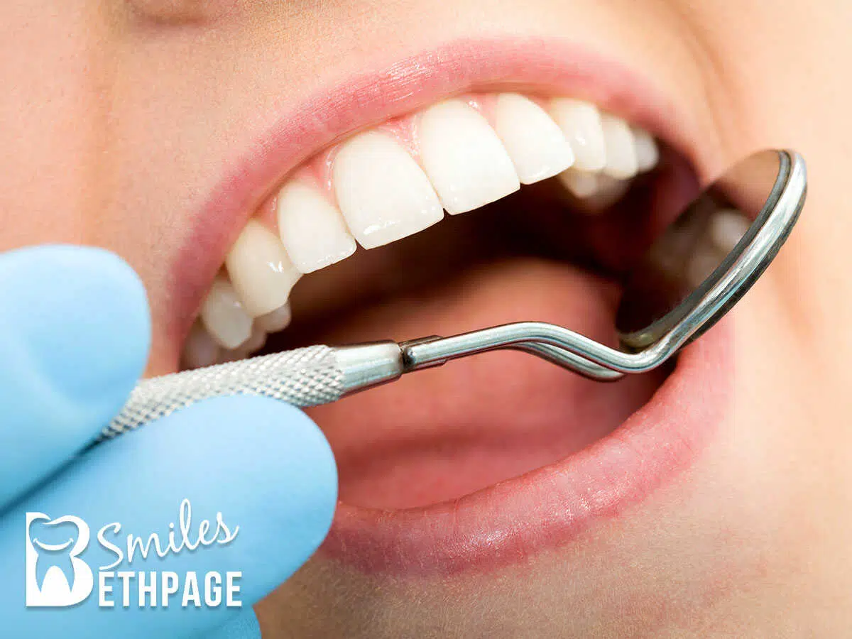Bethpage Dentists Expert Guide For Teeth Whitening Aftercare