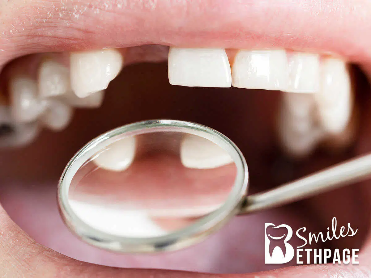 A dentist checking a missing tooth that needs to be replaced in Bethpage, NY.