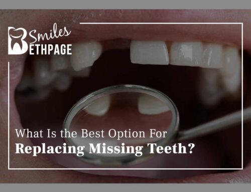 What Is The Best Option For Replacing Missing Teeth?