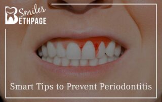 Smart Tips To Prevent Periodontitis