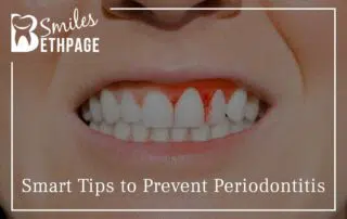 Smart Tips To Prevent Periodontitis