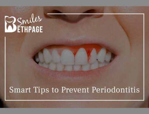 Smart Tips To Prevent Periodontitis