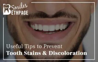 Useful Tips To Prevent Tooth Stains & Discoloration