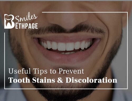 Useful Tips To Prevent Tooth Stains & Discoloration